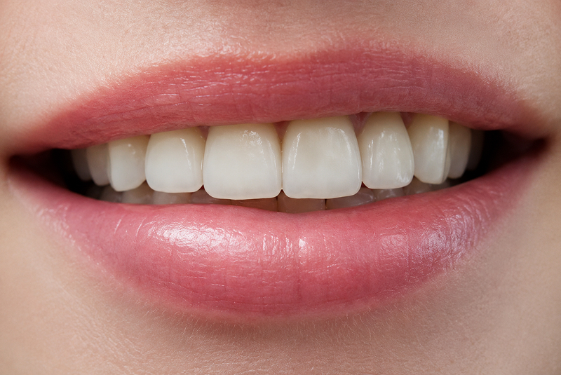 After - Teeth smaller size